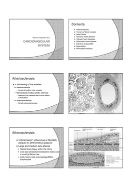 Contents Arteriosclerosis Atherosclerosis