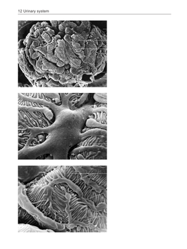 Renal Corpuscle and Tubules of Nephron