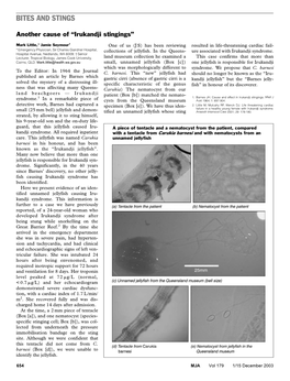 Bites and Stingsand Stings