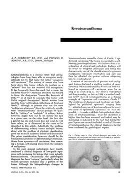 Keratoacanthoma