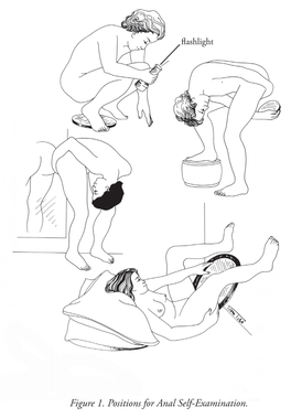 Figure 1. Positions for Anal Self-Examination