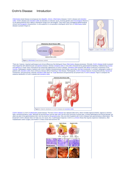 Crohn's Disease: Introduction