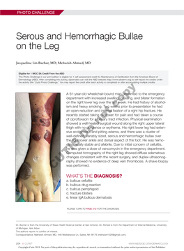 Serous and Hemorrhagic Bullae on the Leg