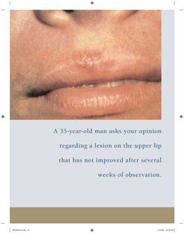 Lip Cancer Is Tively, As Immediate Improvements in Either Status Most Common in Patients with a Fair Complexion, Such Facilitates Likely Surgical Efforts
