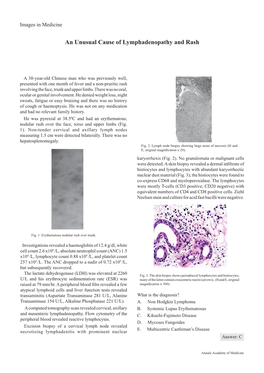 An Unusual Cause of Lymphadenopathy and Rash