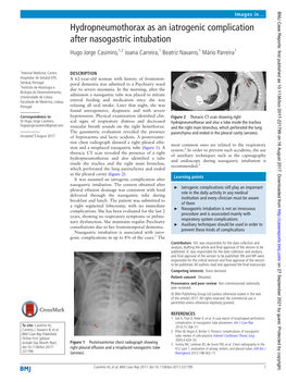 Hydropneumothorax As an Iatrogenic Complication After Nasogastric Intubation Hugo Jorge Casimiro,1,2 Joana Carreira,1 Beatriz Navarro,1 Mário Parreira1