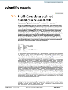 Profilin2 Regulates Actin Rod Assembly in Neuronal Cells