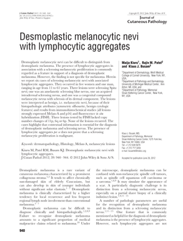 Desmoplastic Melanocytic Nevi with Lymphocytic Aggregates