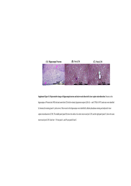 (A) Hippocampal Neurons (B) Pre-LCM (C) Post-LCM