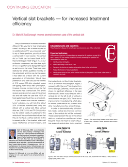 Vertical Slot Brackets — for Increased Treatment Efficiency