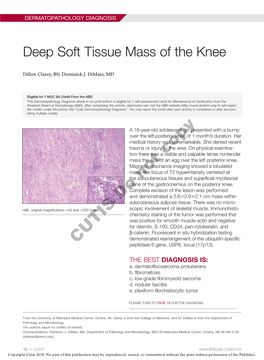 Deep Soft Tissue Mass of the Knee