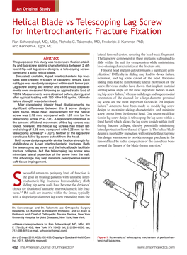 Helical Blade Vs Telescoping Lag Screw for Intertrochanteric Fracture Fixation