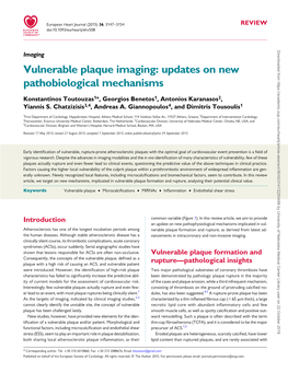 Vulnerable Plaque Imaging: Updates on New Pathobiological Mechanisms