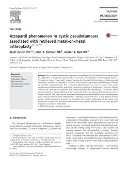 Azzopardi Phenomenon in Cystic Pseudotumours Associated with Retrieved Metal-On-Metal Arthroplasty☆,☆☆ Jozef Zustin MD A,⁎, John A