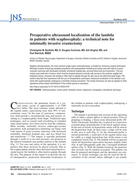 Preoperative Ultrasound Localization of the Lambda in Patients with Scaphocephaly: a Technical Note for Minimally Invasive Craniectomy