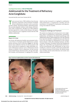 Adalimumab for the Treatment of Refractory Acne Conglobata