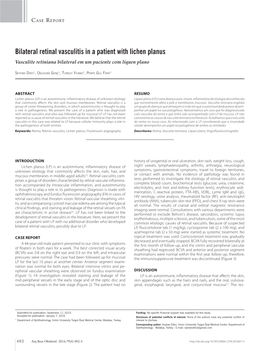 Bilateral Retinal Vasculitis in a Patient with Lichen Planus Vasculite Retiniana Bilateral Em Um Paciente Com Líquen Plano