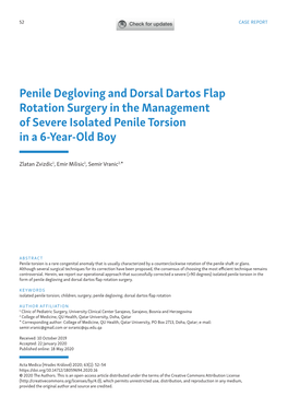 Penile Degloving and Dorsal Dartos Flap Rotation Surgery in the Management of Severe Isolated Penile Torsion in a 6-Year-Old Boy