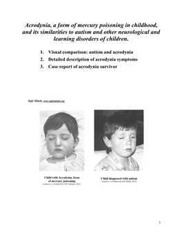 Acrodynia, a Form of Mercury Poisoning in Childhood, and Its Similarities to Autism and Other Neurological and Learning Disorders of Children