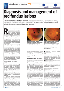 Diagnosis and Management of Red Fundus Lesions