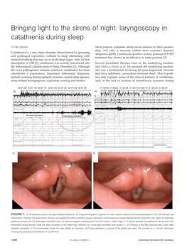 Laryngoscopy in Catathrenia During Sleep