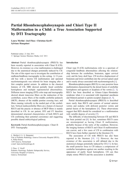 Partial Rhombencephalosynapsis and Chiari Type II Malformation in a Child: a True Association Supported by DTI Tractography