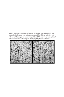 Stained Images of Brodmann's Area 45 in the Left and Right Hemispheres of a Human Brain