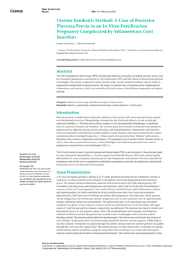 Uterine Sandwich Method: a Case of Posterior Placenta Previa in an in Vitro Fertilization Pregnancy Complicated by Velamentous Cord Insertion