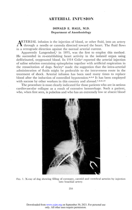 Arterial Infusion