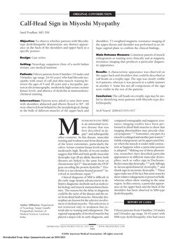 Calf-Head Sign in Miyoshi Myopathy