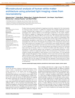 Microstructural Analysis of Human White Matter Architecture Using Polarized Light Imaging: Views from Neuroanatomy