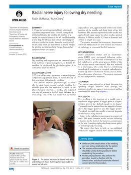 Radial Nerve Injury Following Dry Needling Robin Mcmanus,1 May Cleary2