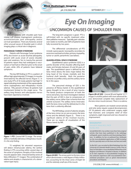 Eye on Imaging UNCOMMON CAUSES of SHOULDER PAIN Most Patients with Shoulder Pain Have the Long-Term Prognosis Is Good