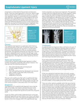 Scapholunate Ligament Injury