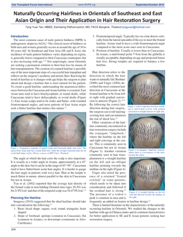 Naturally Occurring Hairlines in Orientals of Southeast and East