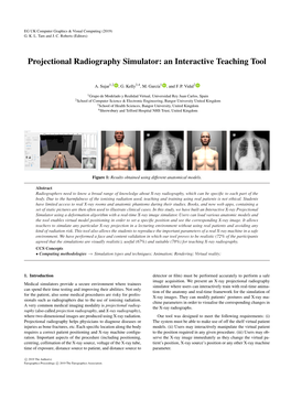 Projectional Radiography Simulator: an Interactive Teaching Tool