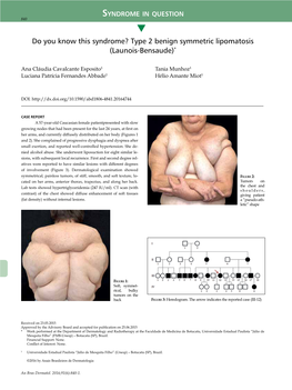 Type 2 Benign Symmetric Lipomatosis (Launois-Bensaude)*