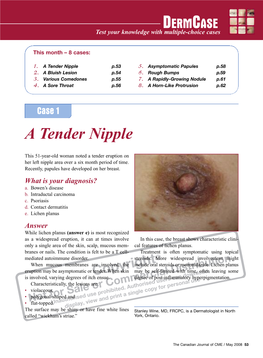 A Tender Nipple P.53 5