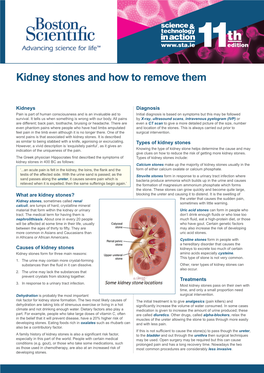 Kidney Stones and How to Remove Them Kidney Stones and How to Remove Them