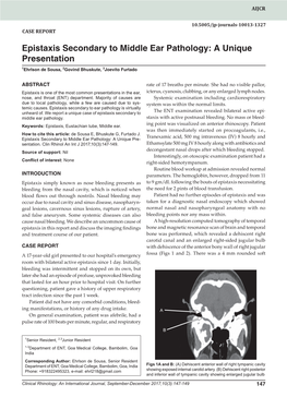 Epistaxis Secondary to Middle Ear Pathology: a Unique Presentation 1Ehrlson De Sousa, 2Govind Bhuskute, 3Joevito Furtado