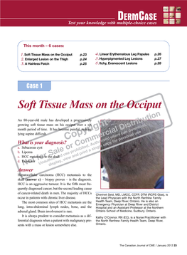 Soft Tissue Mass on the Occiput P.23 4