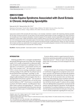 Cauda Equina Syndrome Associated with Dural Ectasia in Chronic Anlylosing Spondylitis