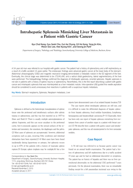 Intrahepatic Splenosis Mimicking Liver Metastasis in a Patient with Gastric Cancer