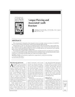 Tongue Piercing and Associated Tooth Fracture