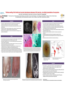 ECCMID Poster Madura