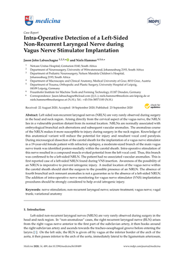 Intra-Operative Detection of a Left-Sided Non-Recurrent Laryngeal Nerve During Vagus Nerve Stimulator Implantation