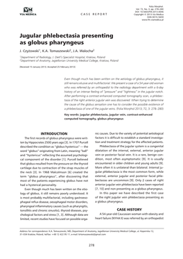 Jugular Phlebectasia Presenting As Globus Pharyngeus J