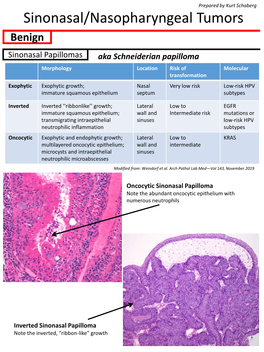 Sinonasal/Nasopharyngeal Tumors Benign