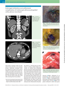 End-Organ Ischemia As an Unforeseen Complication of Endoscopic-Ultrasound-Guided Celiac Plexus Neurolysis1