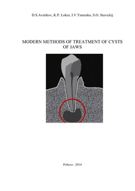 Modern Methods of Treatment of Cysts of Jaws